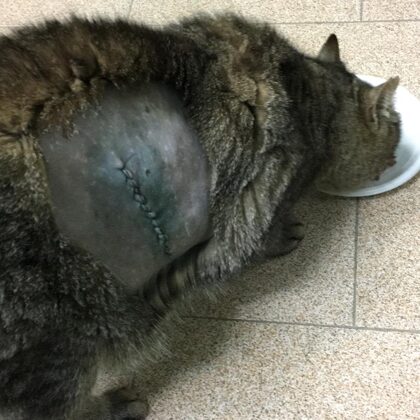 TITO ASPORTAZIONE LIPOMA